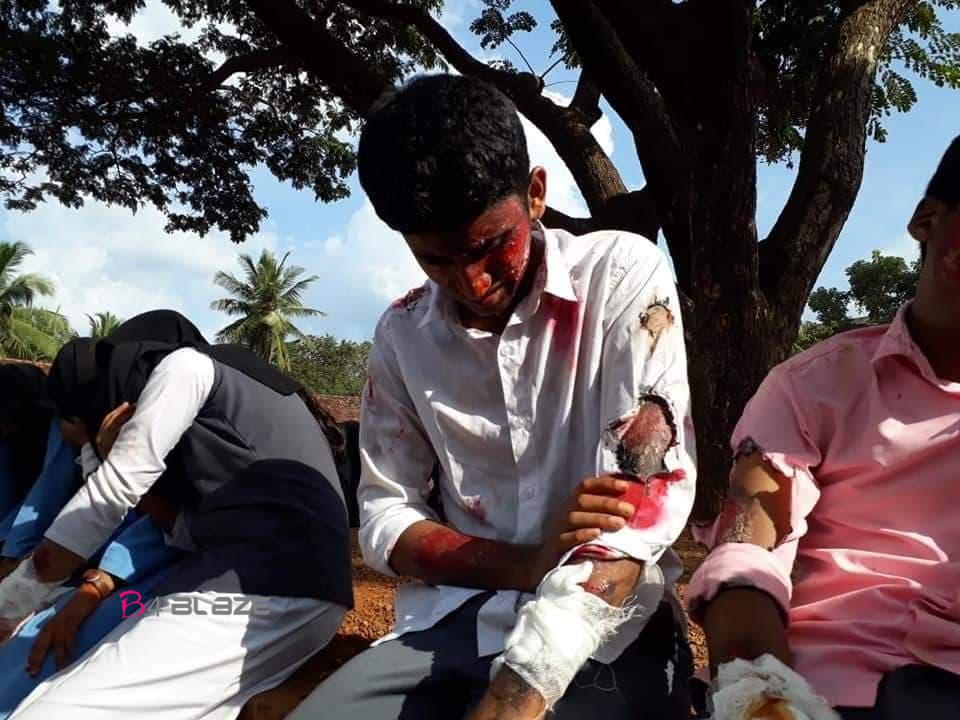 Injured students in Fire