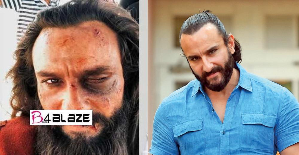 Saif Ali Khan seen in bad condition, has deep injury to eyes, leaked photo is getting viral