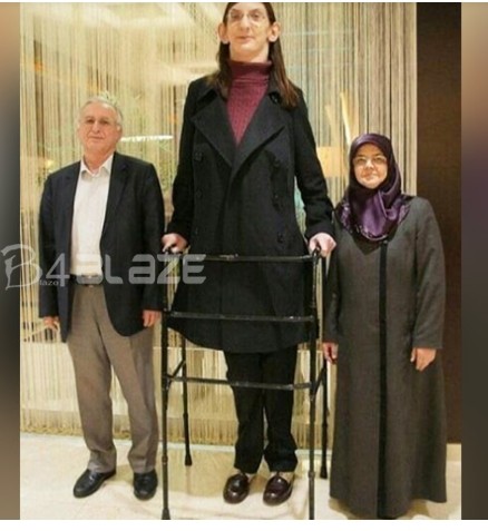 Rumeysa Gelgi tallest women